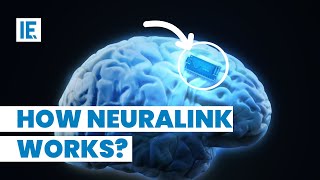 Elon Musk’s Neuralink gets FDA Approval See How It Works [upl. by Fransen]