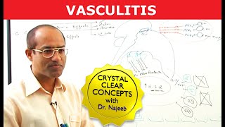 Vasculitis  Causes Symptoms amp Treatment [upl. by Nilloc]