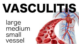 Vasculitis [upl. by Flavia939]