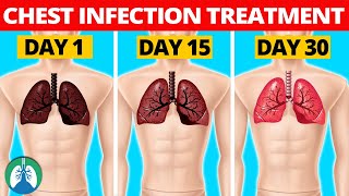 7 Natural Chest Infection Treatments Home Remedies [upl. by Barby849]