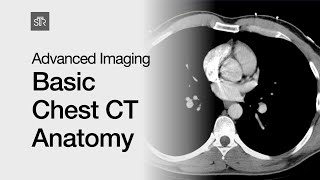 Advanced Imaging Basic Chest CT Anatomy [upl. by Natsyrk664]