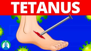 Tetanus Medical Definition  Quick Explainer Video [upl. by Ashmead]