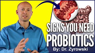 Probiotic Benefits  Top Signs You Should Be Taking A Probiotics [upl. by Rentschler687]