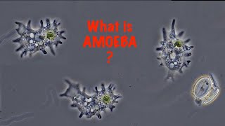 What is Amoeba [upl. by Sitra]