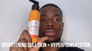 HOW I GOT RID OF DARK SPOTS BRIGHTEN DULL SKIN  HYPERPIGMENTATION [upl. by Nnaasil111]