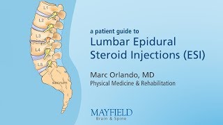 Lumbar Epidural Steroid Injections [upl. by Purity24]