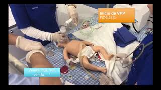 REANIMACION NEONATAL ALGORITMO COMPLETO [upl. by Pernick241]