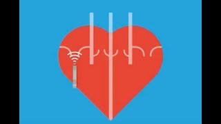 Atrial Fibrillation On Echocardiogram [upl. by Burta249]