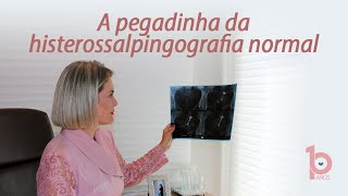 A pegadinha da histerossalpingografia normal [upl. by Ahsitak]