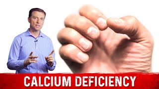 Causes amp Symptoms Of Calcium Deficiency – Dr Berg [upl. by Reinal]