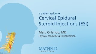 Cervical Epidural Steroid Injection [upl. by Ecyrb]