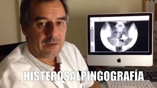 Qué es una Histerosalpingografía ⭐ Dr Josep Vives Roura [upl. by Anoek60]