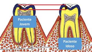 4ª Aula Dentística  Proteção do complexo dentinopulpar [upl. by Arakaj]