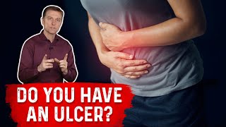 Understanding Ulcers How Do You Know If You Have One – Dr Berg [upl. by Camila]