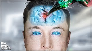 How Neuralink Will Cure Blindness [upl. by Vannie]