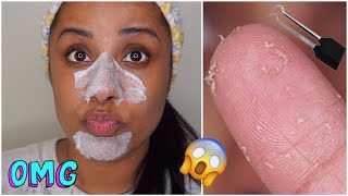 DIY Pore Strips Get Rid of BlackheadsWhiteheads  EASY [upl. by Cameron560]