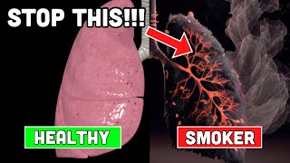 5 Home Remedies to Help You Quit Smoking [upl. by Nylahs]