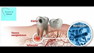 Cariologia  Resumos de Odonto [upl. by Rebe439]