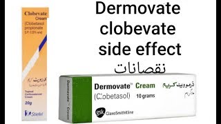 clobetasol propionate side effects clobevate cream dermovate cream [upl. by Ahsemad]